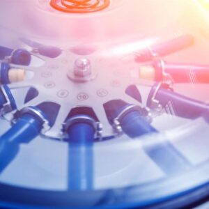 Human Platelet Lysate