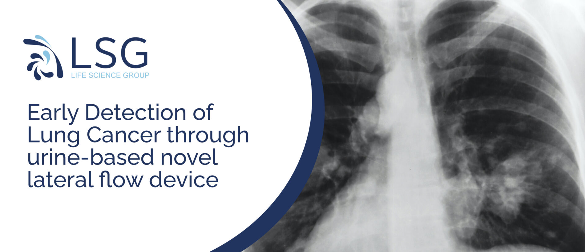 Read more about the article Life Science Group to Aid in Earlier Lung Cancer Detection