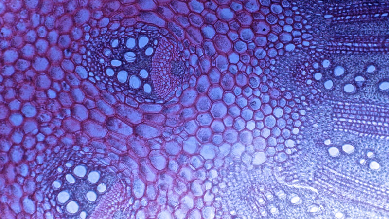 biospecimens - tissue