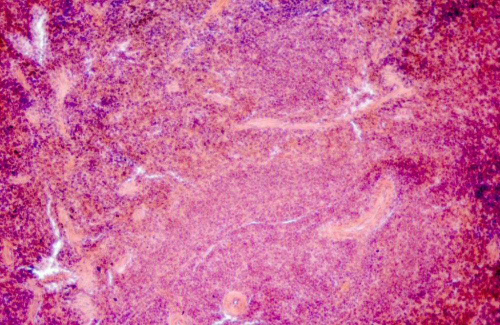 biospecimens - tissue